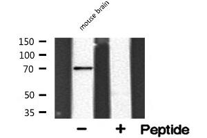 Image no. 1 for anti-Synaptotagmin Binding, Cytoplasmic RNA Interacting Protein (SYNCRIP) antibody (ABIN6257868)