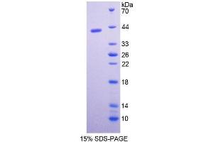 Image no. 1 for Pepsinogen C (PGC) (AA 17-392) protein (His tag) (ABIN1080478)
