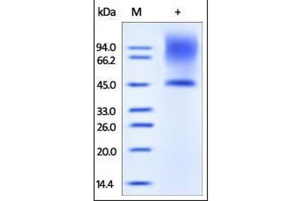 Decorin (DCN) (AA 17-359) protein (His tag)