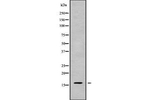 Image no. 1 for anti-Calmodulin-Like 5 (CALML5) (Internal Region) antibody (ABIN6260415)