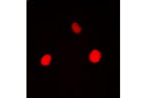 Image no. 2 for anti-Hexokinase 1 (HK1) (N-Term) antibody (ABIN2707548)
