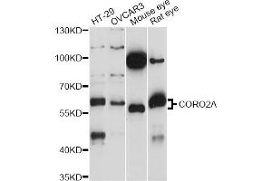 Image no. 1 for anti-Coronin, Actin Binding Protein, 2A (CORO2A) antibody (ABIN6293915)