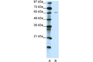 Image no. 1 for anti-Zinc Finger Protein 268A (ZNF286A) (C-Term) antibody (ABIN2781107)