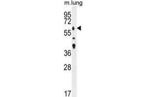 Image no. 3 for anti-Transforming Growth Factor, beta Receptor II (70/80kDa) (TGFBR2) (AA 20-48), (N-Term) antibody (ABIN955177)