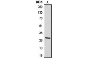 Image no. 1 for anti-Deiodinase, Iodothyronine, Type III (DIO3) (Center) antibody (ABIN2706038)