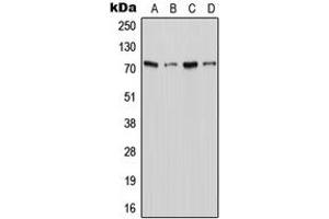 Image no. 1 for anti-Solute Carrier Family 6, Member 18 (SLC6A18) (C-Term) antibody (ABIN2705335)