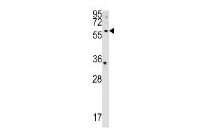 CDS2 antibody  (AA 138-165)