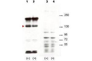 Image no. 1 for anti-Signal-Induced Proliferation-Associated 1 (SIPA1) antibody (ABIN233836)