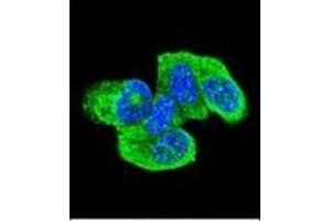 Image no. 3 for anti-HRas proto-oncogene, GTPase (HRAS) (AA 153-184), (C-Term) antibody (ABIN952792)