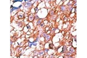 Image no. 4 for anti-V-Erb-A erythroblastic Leukemia Viral Oncogene Homolog 4 (Avian) (ERBB4) (pTyr1162) antibody (ABIN3029487)