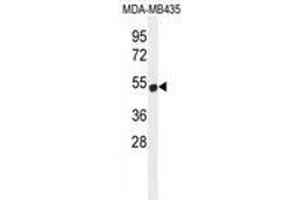 Image no. 1 for anti-Zinc Finger Protein 286B (ZNF286B) (AA 103-132), (N-Term) antibody (ABIN955699)