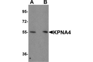 Image no. 1 for anti-Karyopherin (Importin) alpha 4 (KPNA4) (N-Term) antibody (ABIN783731)