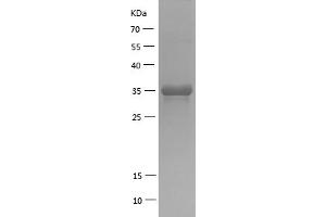Western Blotting (WB) image for Bone Morphogenetic Protein 2 (BMP2) (AA 283-396) protein (His-IF2DI Tag) (ABIN7122011)