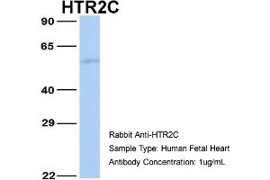 Image no. 6 for anti-5-Hydroxytryptamine (serotonin) Receptor 2C (HTR2C) (N-Term) antibody (ABIN2792274)