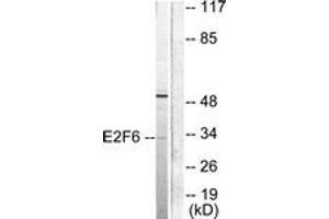 Image no. 1 for anti-E2F Transcription Factor 6 (E2F6) (AA 141-190) antibody (ABIN1533260)