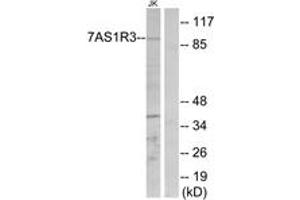 anti-Taste Receptor, Type 1, Member 3 (TAS1R3) (AA 326-375) antibody
