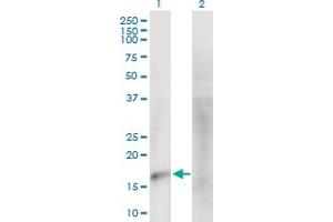 Western Blot analysis of MARVELD1 expression in transfected 293T cell line by MARVELD1 MaxPab polyclonal antibody.