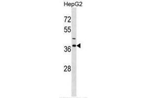 Image no. 1 for anti-Immunoglobulin (CD79A) Binding Protein 1 (IGBP1) (AA 141-171), (Middle Region) antibody (ABIN952830)