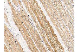 Image no. 1 for anti-Blood Vessel Epicardial Substance (BVES) (C-Term) antibody (ABIN6924277)
