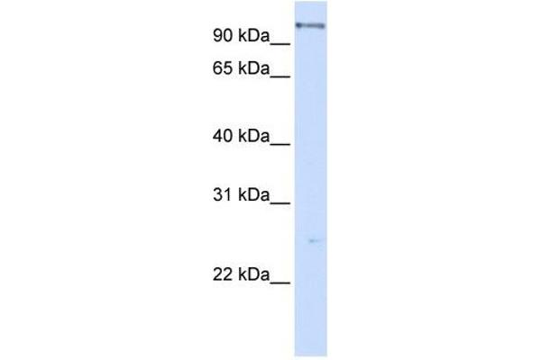 anti-DEAH (Asp-Glu-Ala-His) Box Polypeptide 15 (DHX15) antibody