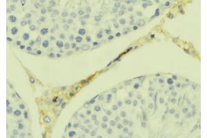 Image no. 1 for anti-Tumor Necrosis Factor (Ligand) Superfamily, Member 12 (TNFSF12) (N-Term) antibody (ABIN6265650)