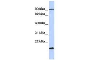 TM4SF4 anticorps  (N-Term)