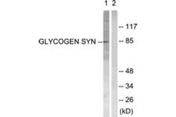 Glycogen Synthase antibody  (AA 621-670)