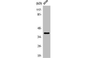 KCNK15 Antikörper  (C-Term)