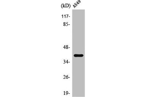 KCNK15 Antikörper  (C-Term)