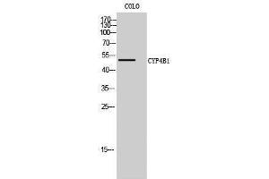 Image no. 1 for anti-Cytochrome P450, Family 4, Subfamily B, Polypeptide 1 (CYP4B1) (Internal Region) antibody (ABIN3184199)
