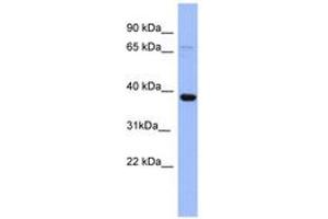 Image no. 1 for anti-Immediate Early Response 5 (IER5) (N-Term) antibody (ABIN6741712)