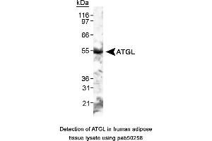 Image no. 1 for anti-Patatin-Like phospholipase Domain Containing 2 (PNPLA2) (AA 400-500), (C-Term) antibody (ABIN363567)