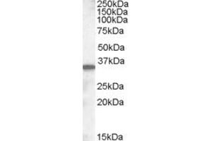 Image no. 1 for anti-Solute Carrier Family 10 (Sodium/bile Acid Cotransporter Family), Member 2 (SLC10A2) (C-Term) antibody (ABIN335162)