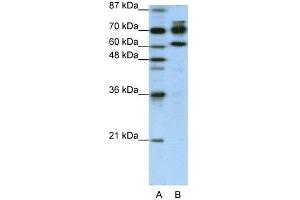 Image no. 1 for anti-Adenosine Deaminase, RNA-Specific, B1 (ADARB1) (N-Term) antibody (ABIN2778757)
