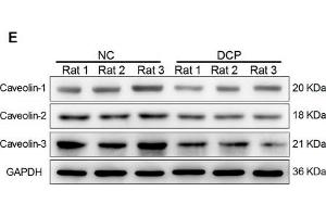 Down-regulation of caveolae number and Caveolin1-3 expressions in DCP bladder ICCs-DM.