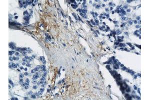 MT-ND6 antibody  (AA 51-150)