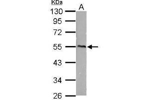 WB Image CaMKI gamma antibody detects CaMKI gamma protein by Western blot analysis.
