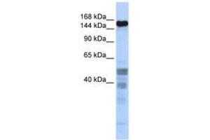 Image no. 1 for anti-Zinc Finger Protein 335 (ZNF335) (C-Term) antibody (ABIN6740611)