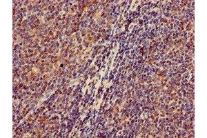 Immunohistochemistry of paraffin-embedded human lymph node tissue using ABIN7176612 at dilution of 1:100