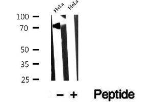 Image no. 1 for anti-Nuclear Fragile X Mental Retardation Protein Interacting Protein 1 (NUFIP1) (Internal Region) antibody (ABIN6263766)