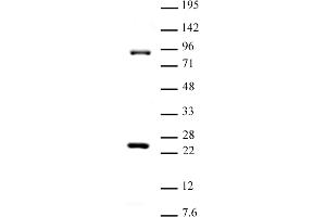 Image no. 1 for anti-SUZ12 Polycomb Repressive Complex 2 Subunit (SUZ12) (C-Term) antibody (ABIN6972836)