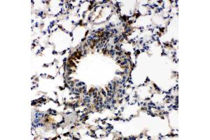Anti-Caspase-6(P18) antibody, IHC(P): Mouse Lung Tissue