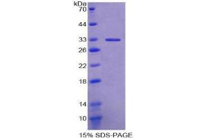Image no. 1 for Ectonucleoside Triphosphate diphosphohydrolase 1 (ENTPD1) (AA 241-486) protein (His tag) (ABIN2124690)