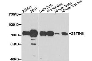 Image no. 2 for anti-Zinc Finger and BTB Domain Containing 48 (ZBTB48) antibody (ABIN6150386)