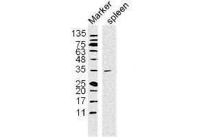 Image no. 3 for anti-Nuclear Factor of kappa Light Polypeptide Gene Enhancer in B-Cells Inhibitor, alpha (NFKBIA) (AA 1-120) antibody (ABIN674454)