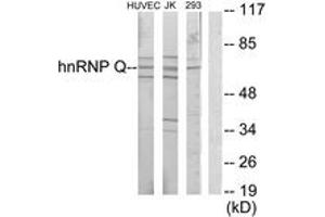 Image no. 1 for anti-Synaptotagmin Binding, Cytoplasmic RNA Interacting Protein (SYNCRIP) (AA 236-285) antibody (ABIN1533522)