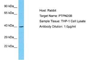 Host: Rabbit Target Name: PTPN20B Sample Type: THP-1 Whole Cell lysates Antibody Dilution: 1.