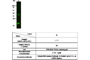 Image no. 2 for anti-gamma-Interferon-Induced Monokine (CXCL9) (AA 23-125) antibody (ABIN1997719)