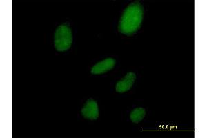 Image no. 4 for anti-Small Nuclear RNA Activating Complex, Polypeptide 1, 43kDa (SNAPC1) (AA 1-368) antibody (ABIN520331)