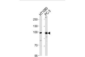 Image no. 1 for anti-Zinc Finger Protein 560 (ZNF560) antibody (ABIN3004763)